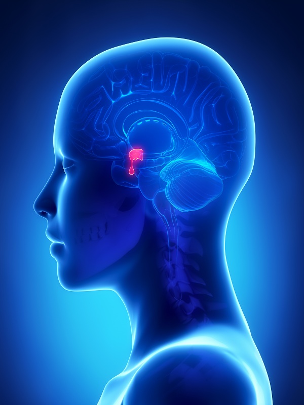 Cushing's Syndrome