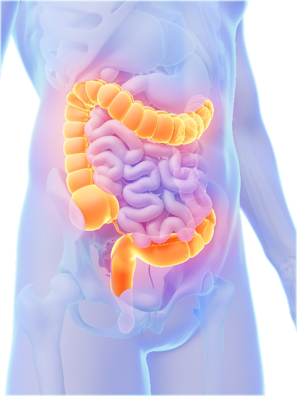 Diarrhea in Adults - Infectious