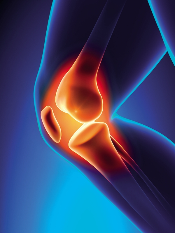 Infectious Arthritis