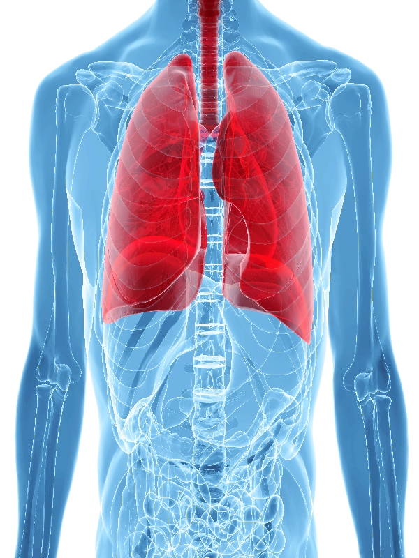 Tuberculosis - Pulmonary
