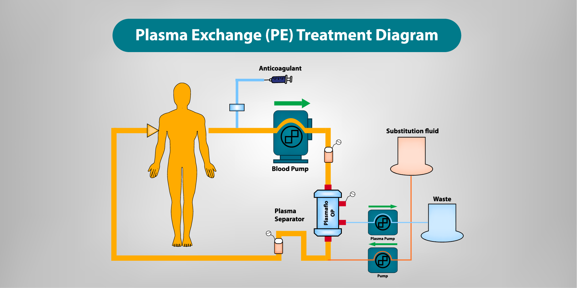 Systemic Lupus Erythematosus_Management 3