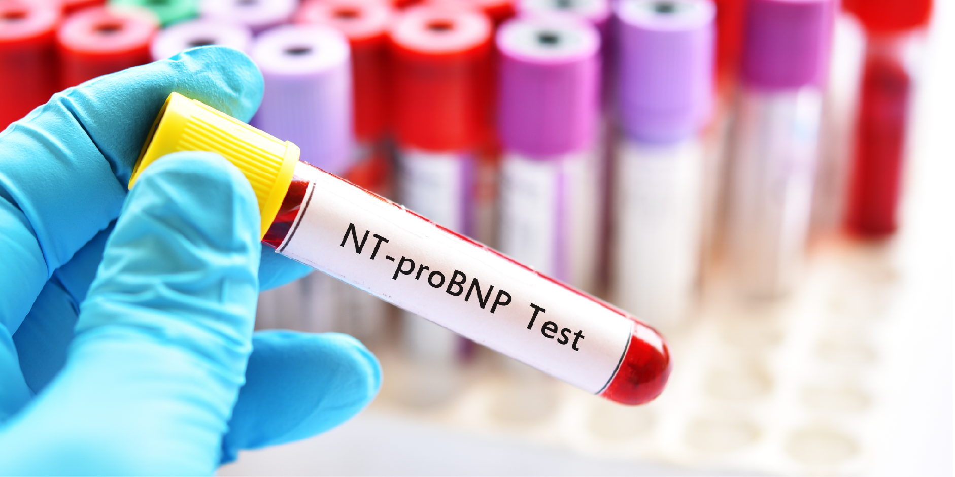 Heart Failure - Chronic_Diagnostics