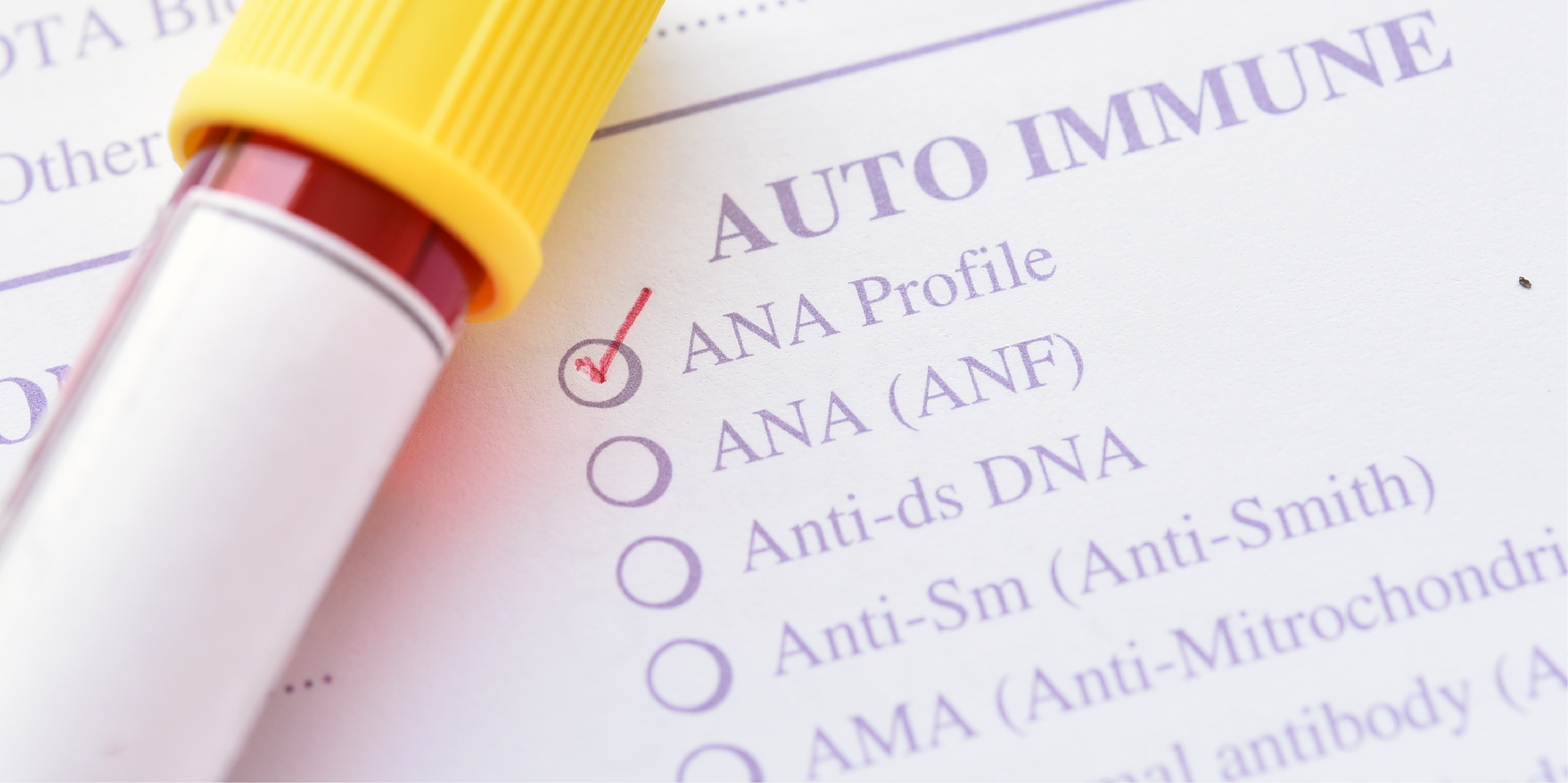 Systemic Lupus Erythematosus_Initial Assessment 2